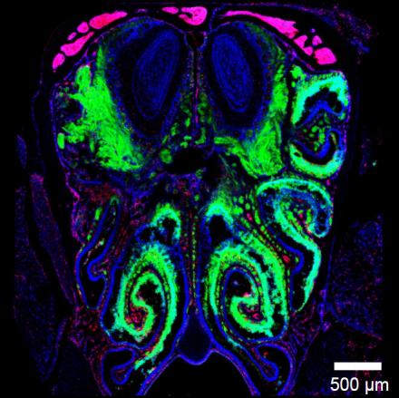 Image of viral infection thwarted just outside the CNS. When virus (labeled in green) enters the nasal passages, its spread is abruptly halted just before entering the CNS. Credit: McGavern Lab